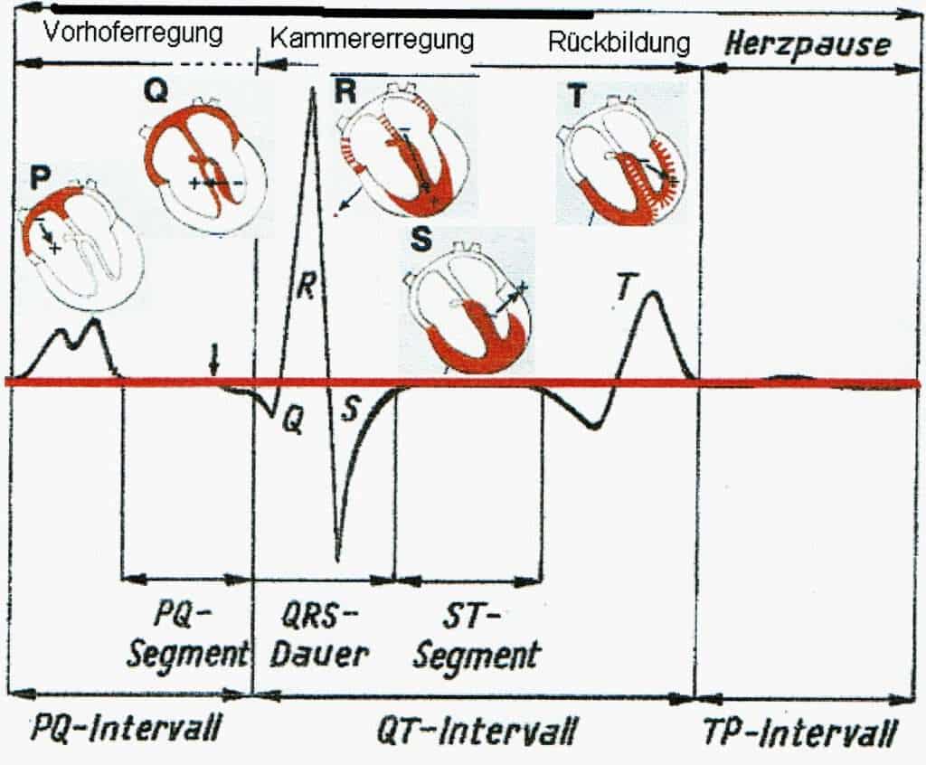 Abb.: EKG und Erregungszustand der Herzmuskulatur (modifiziert nach Bartels, 1987: Physiologie. Verlag Urban & Schwarzenberg)