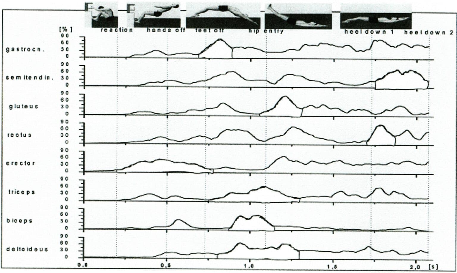 Suchbegriff: Elektromyografie?