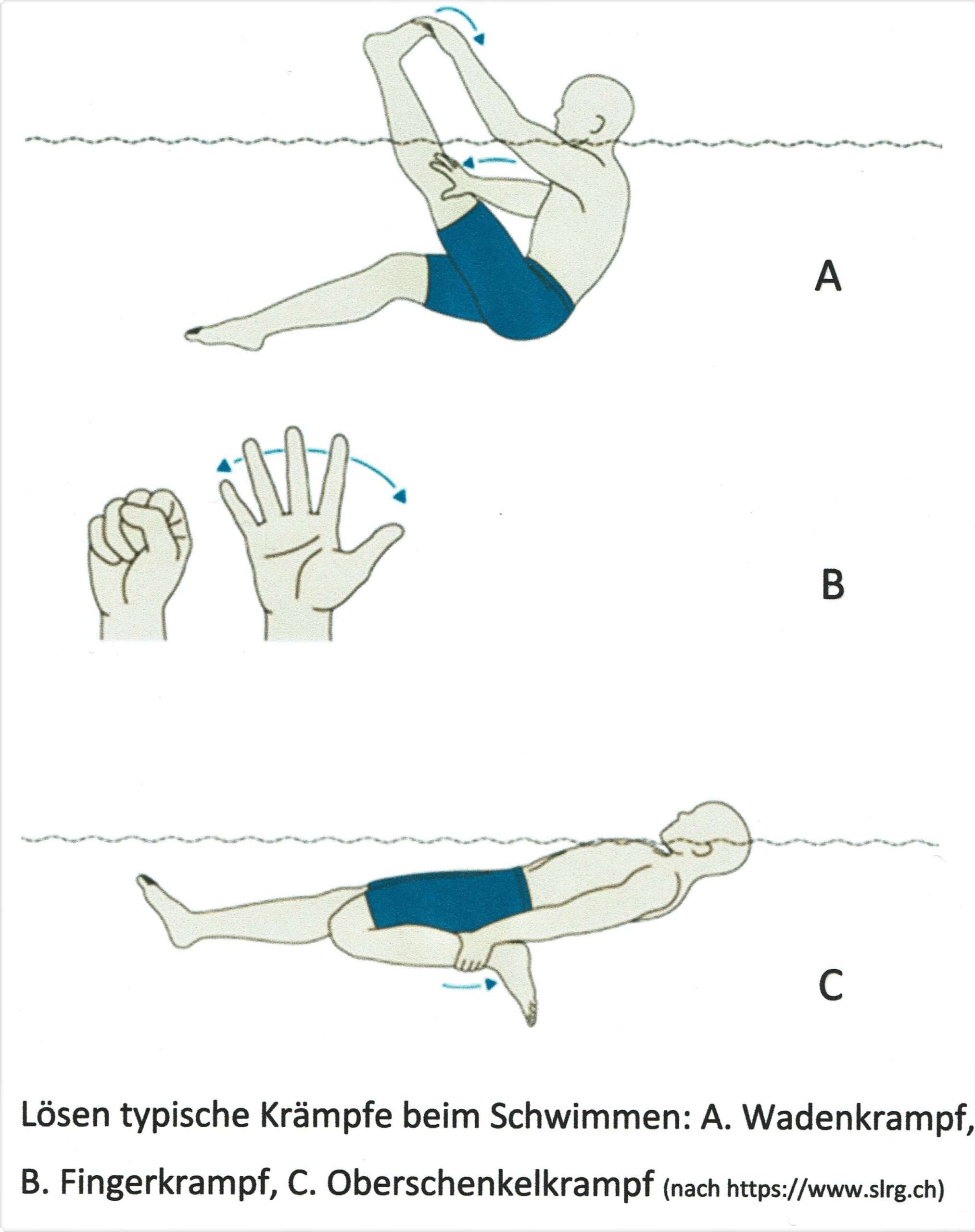 Muskelkrampf | SWIMLEX | Das Lexikon Des Schwimmsports